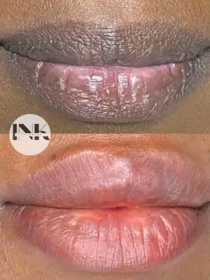 Lip color correction Lakeland results