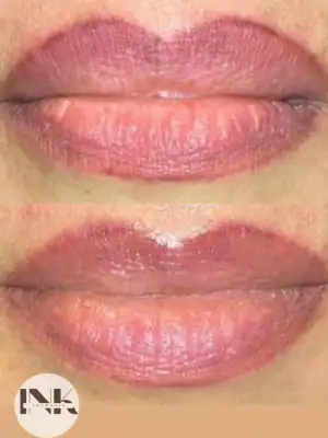 Permanent makeup removal lakeland fl lip blush color correction and faded pigment revision