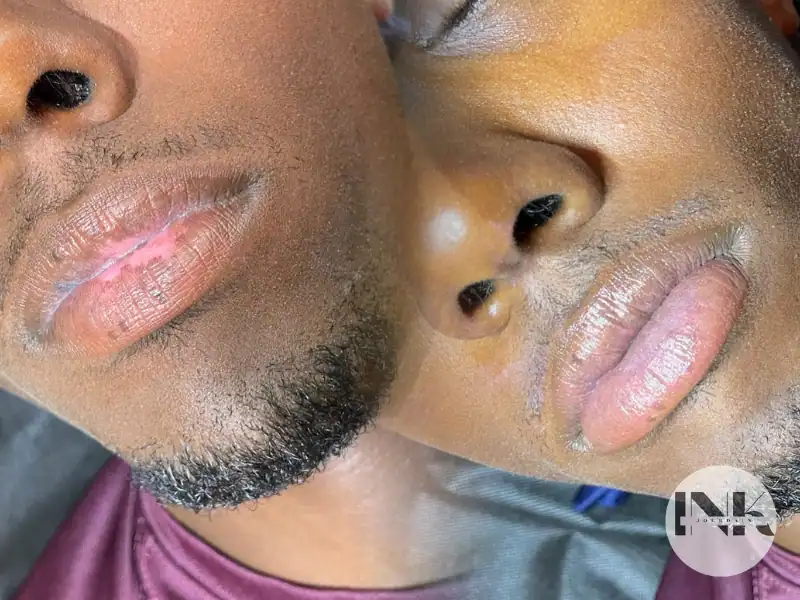 Pigment Neutralization Lip Blush Correction Lakeland